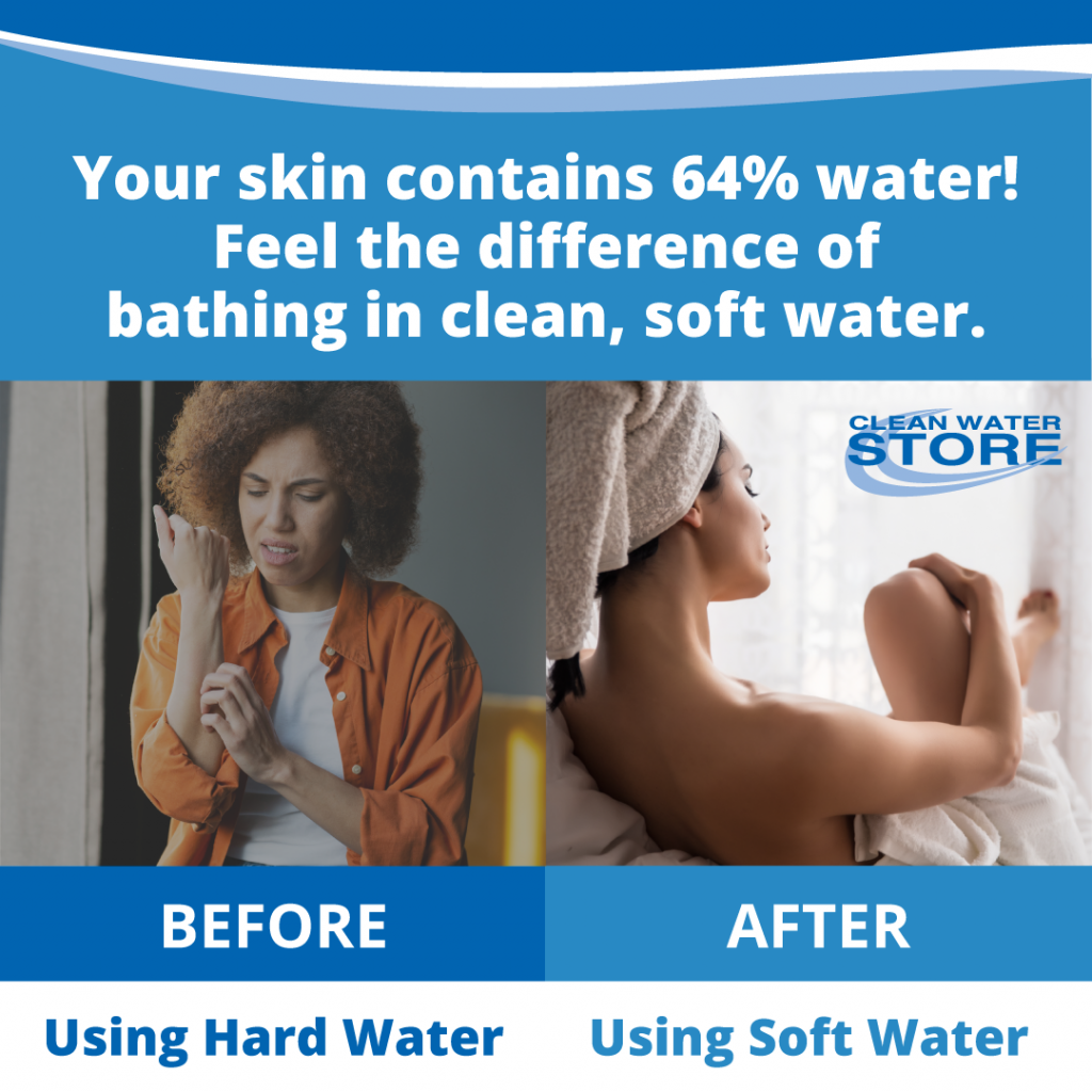 Side-by-side comparison of a woman with dry, irritated skin from hard water versus a woman with smooth, healthy skin after using soft water, with text highlighting that skin contains 64% water and benefits from clean, soft water.
