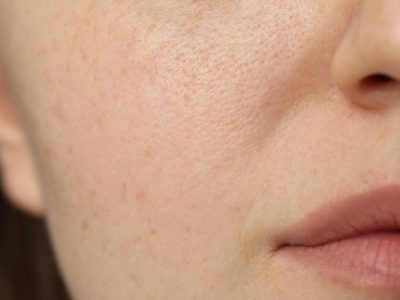 Winter Water 101: Chloramine, Dry Skin & Tap Water Taste — What’s Normal?