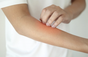 Dry itchy skin after a shower could be a sign of high chlorine in water.